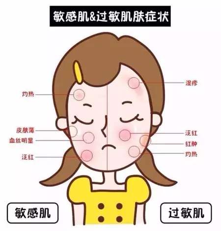皮肤过敏的原因有哪些