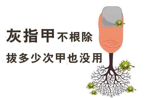 灰指甲是怎样引起的