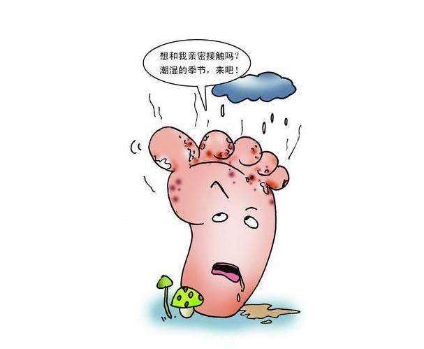 手足癣包括哪些症状类型