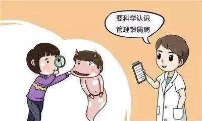 背部牛皮癣怎么治疗