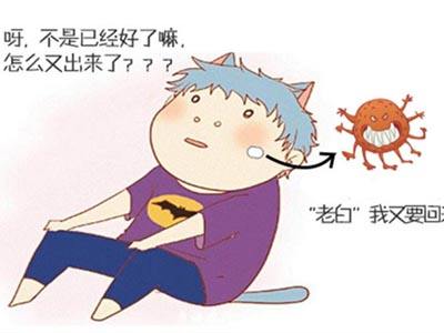 如何治疗白癜风